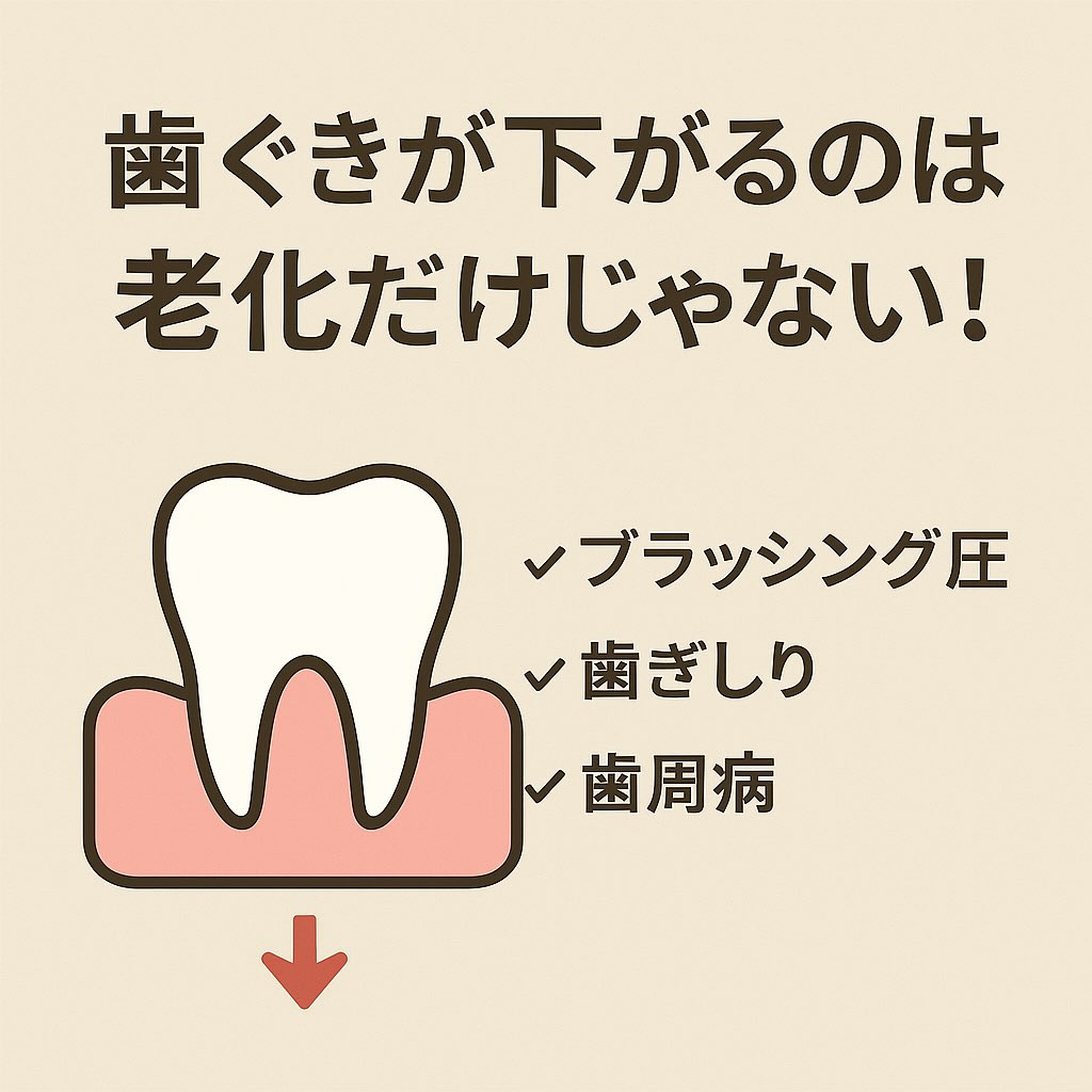 歯ぐきが下がるのは、老化だけが原因じゃないんです