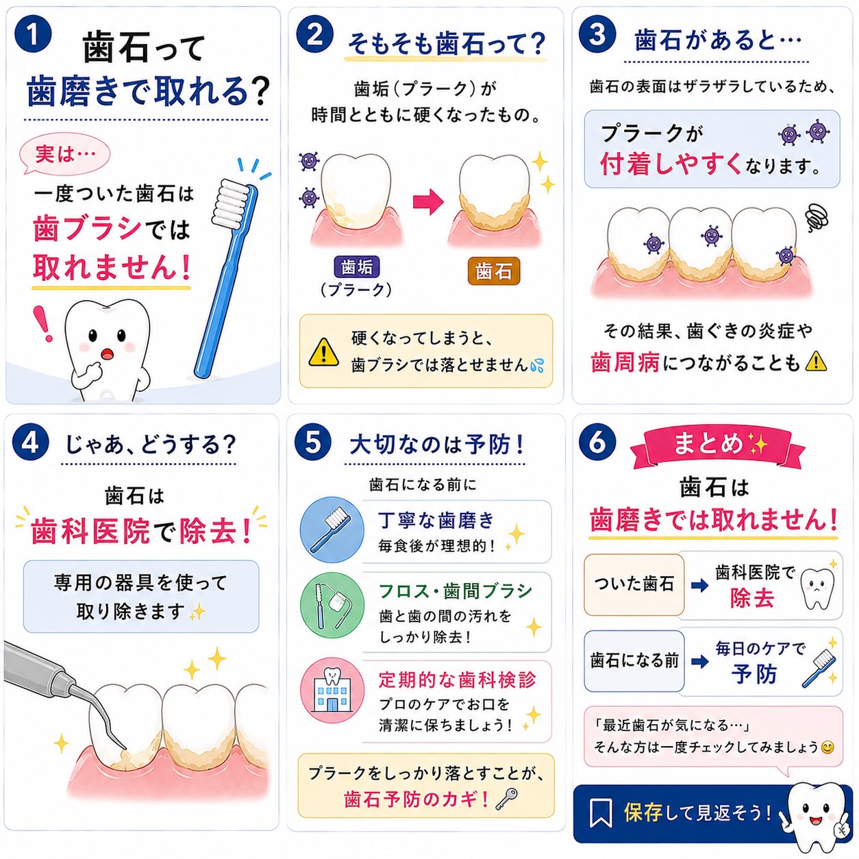 「歯石って、歯磨きで取れるの？」